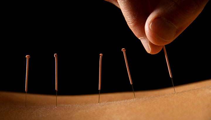 Winter Acupuncture Helps