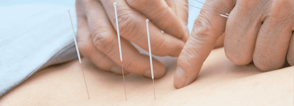 acupuncture services in oriole