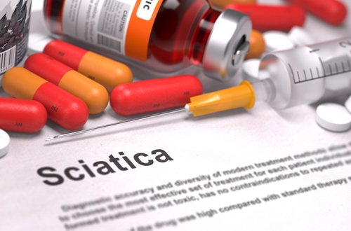 A Real Pain: Gradual Causes Of Sciatica