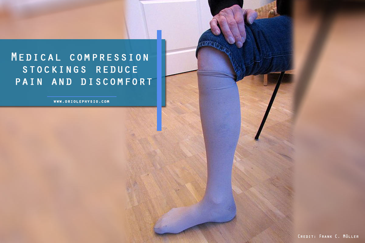 Medical compression stockings reduce pain and discomfort