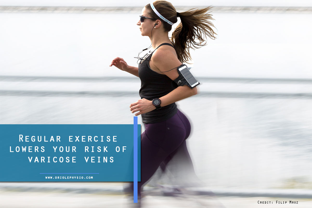 Regular exercise lowers your risk of varicose veins
